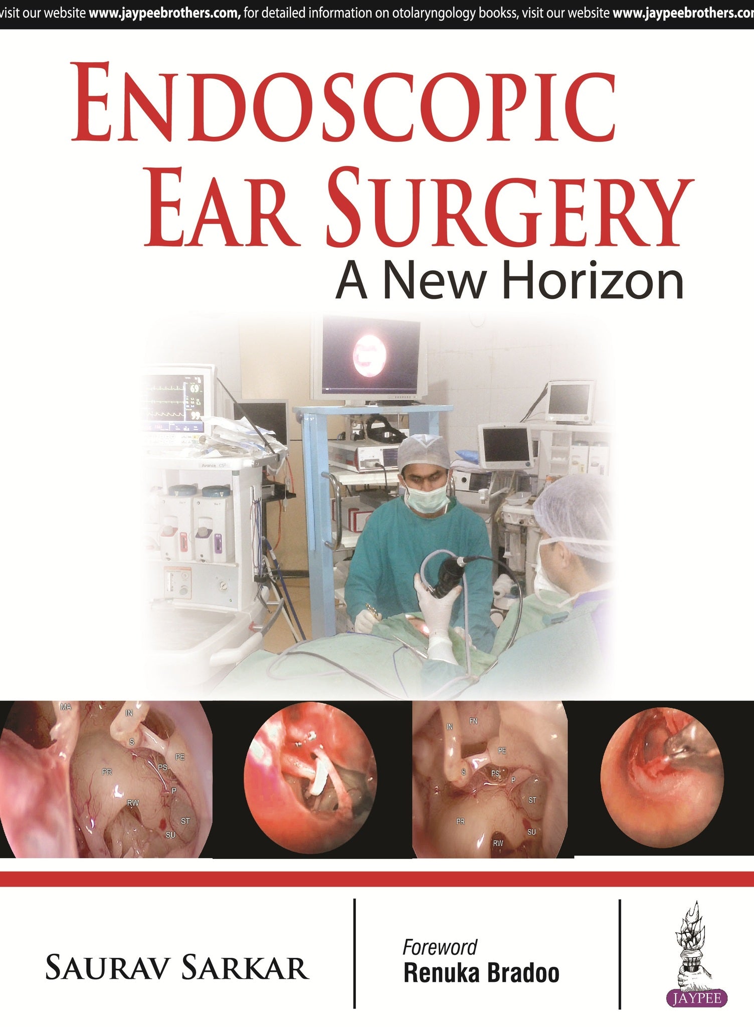 Endoscopic Ear Surgery